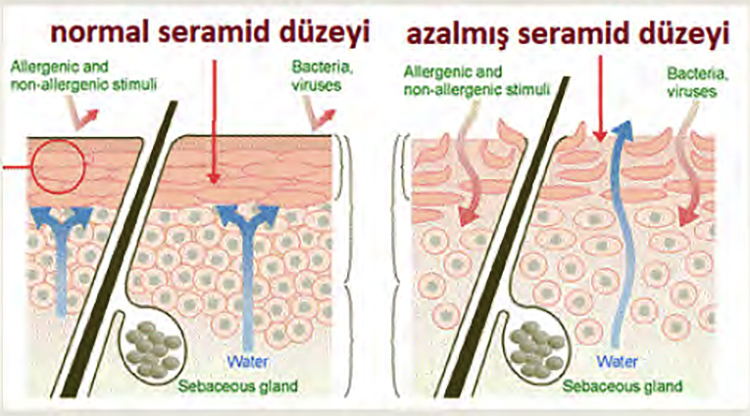 Seramid Nedir?